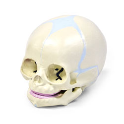 Crânio Fetal