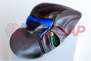 modelo figado com vesicula biliar