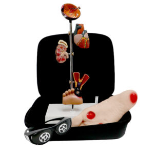 Kit de Educação para Diabetes