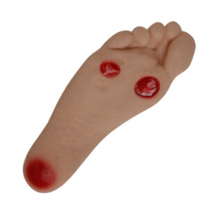 Modelo de úlcera do pé diabético