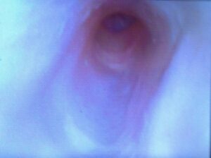 Endoscopia - Simulador