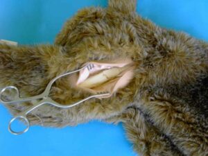 Fratura óssea da perna femoral